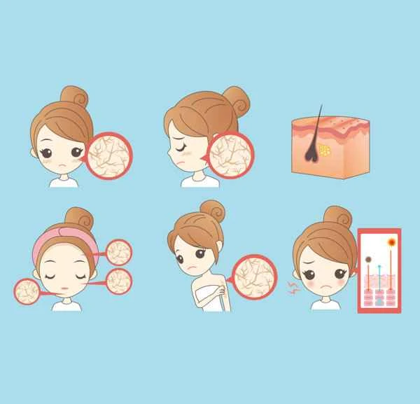 How to remove keloid scars?