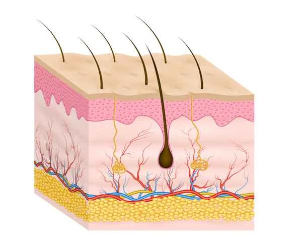 How to describe large keloid scars?