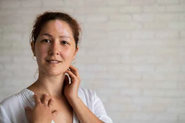 How to cover up red scars?