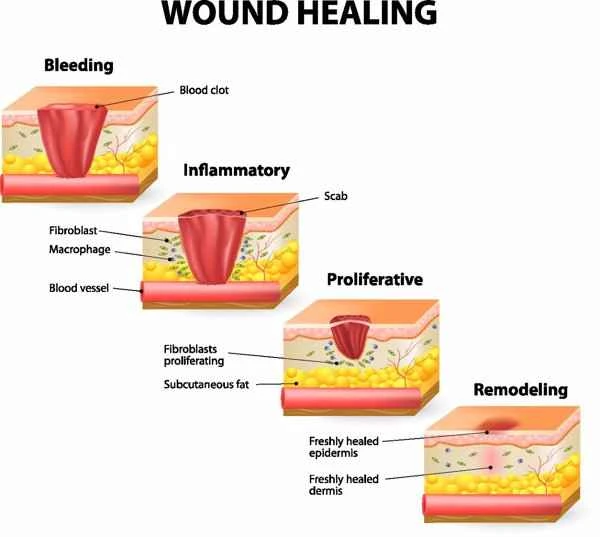 How long does it usually take for a scar to appear?