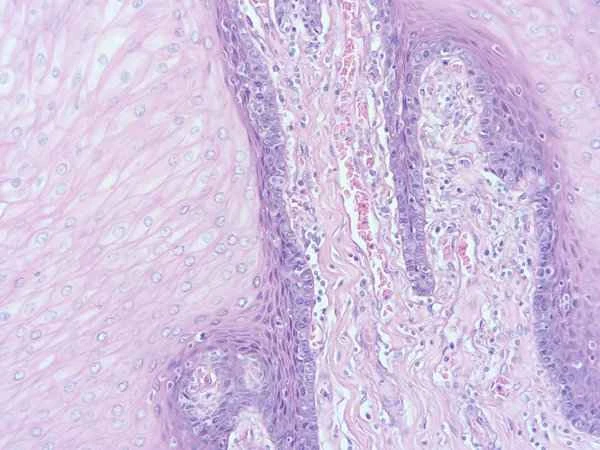 There is a raised purple fleshy bump on the inside of the lip