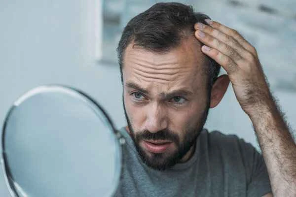 How to diagnose male pattern baldness