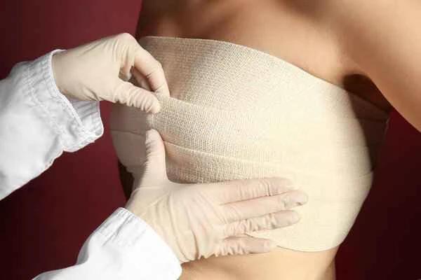How to change dressings after keloid surgery