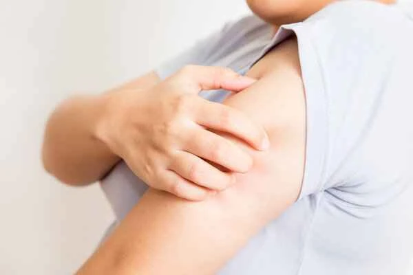 What causes itching from needle pricks on the body?